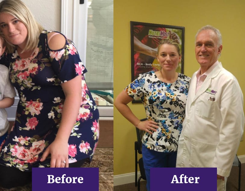 Before and After Angela's Weight Loss Journey
