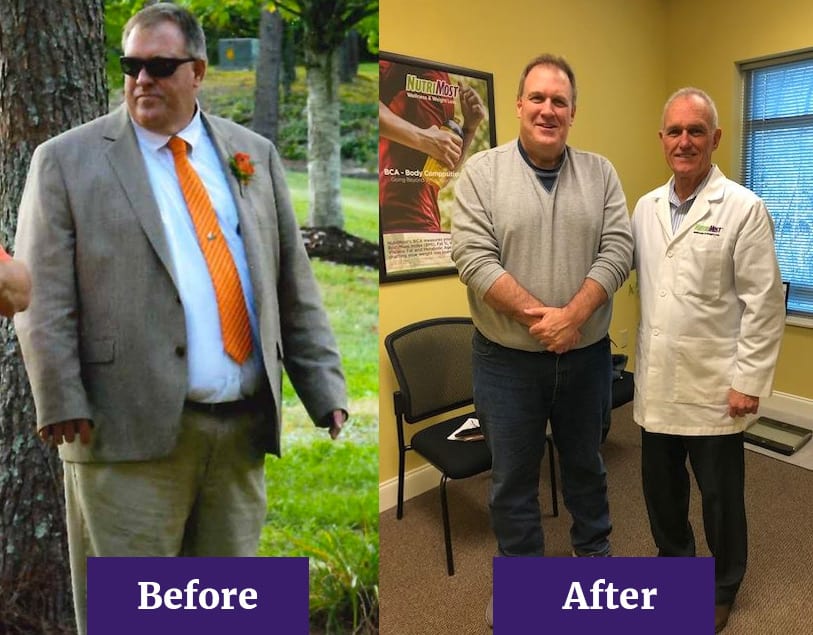 Before and After Rick's Weight Loss Journey